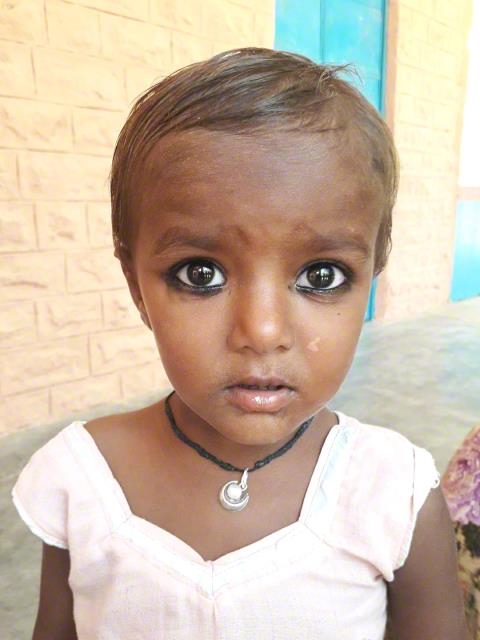 World Vision India